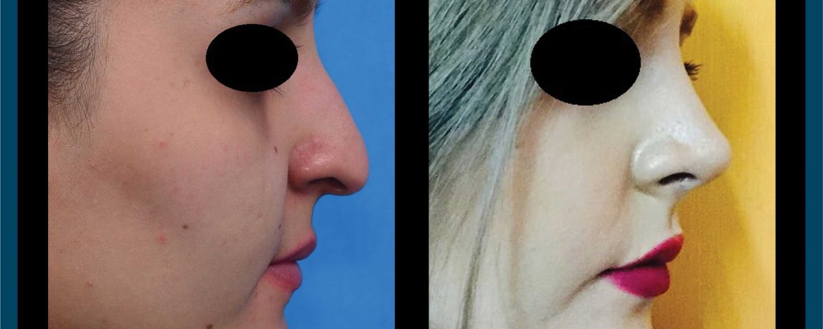 عکس قبل و بعد از عمل 104