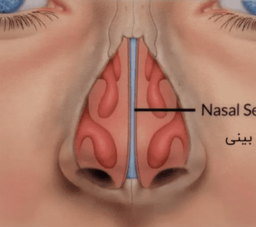 همه چیز در مورد تیغه ی بینی