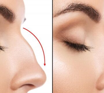 انواع عمل های ترمیم بینی