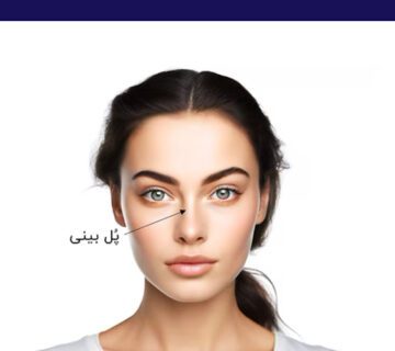 پل بینی چیست