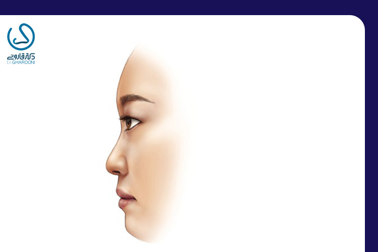 پل بینی کوچک