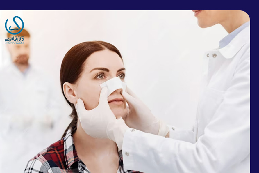 تصویر گچ یا اسپلینت بینی