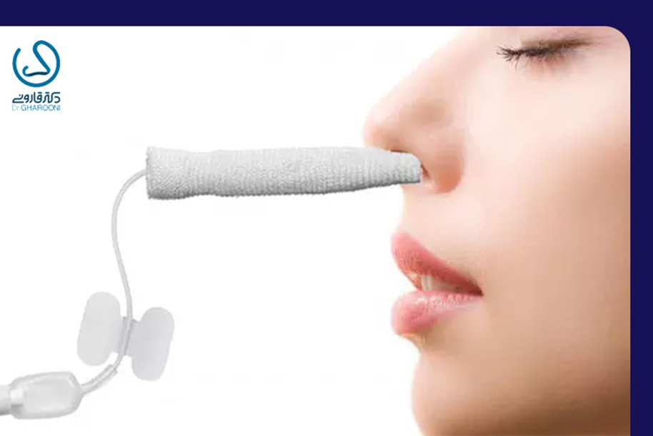 بررسی انواع اسپیلنت یا گچ داخل بینی