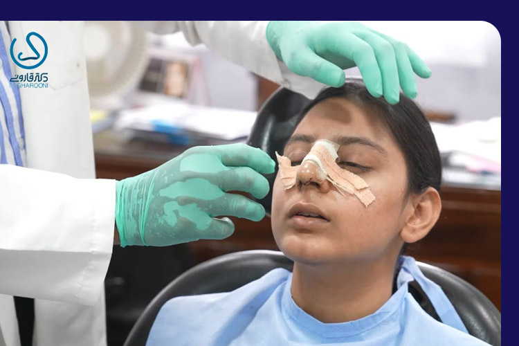 برداشتن گچ بینی بعد از عمل بینی