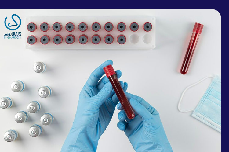 آزمایش ایدز از آزمایشات قبل از عمل بینی