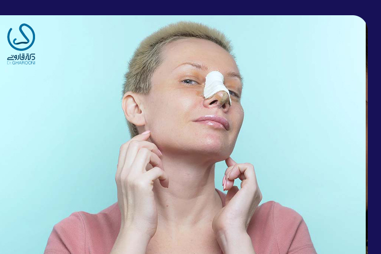 آیا کبودی بعد از عمل بینی خطرناک است؟