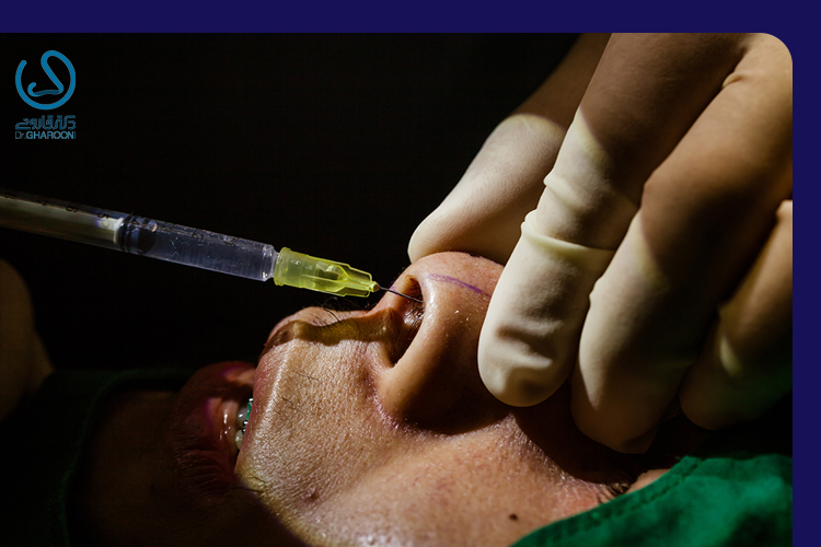 کورتون معمولا به کدام قسمت از بینی تزریق میشود؟