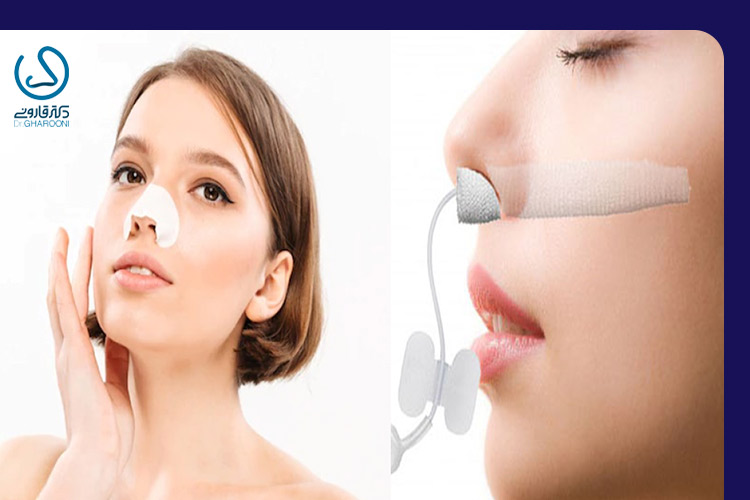 تفاوت تامپون و اسپلینت بینی