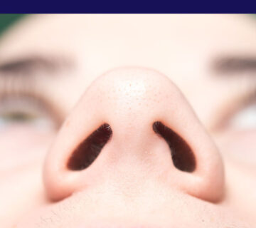 عدم تقارن سوراخ‌های بینی بعد از جراحی بینی