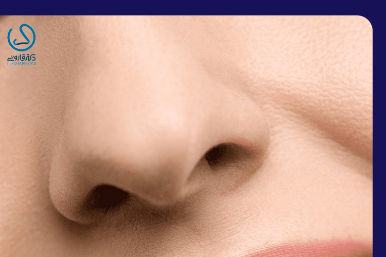راههای درمان عدم قرینگی سوراخهای بینی