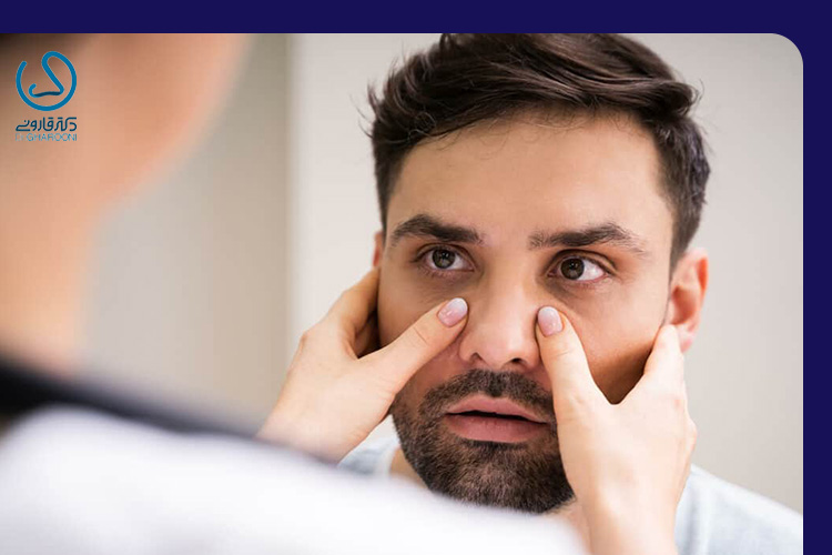 One-sided nasal congestion