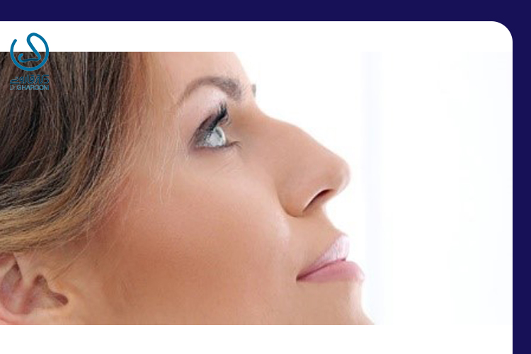 بازگشت قوز بینی