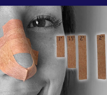 چسب زدن بینی بعد از عمل