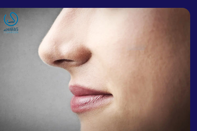 فرم‌ دهی بینی بدون جراحی 