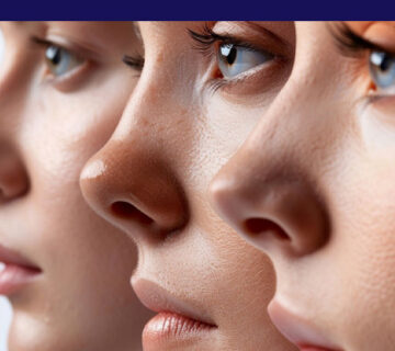 بهترین روش فرم دهی بینی بدون جراحی