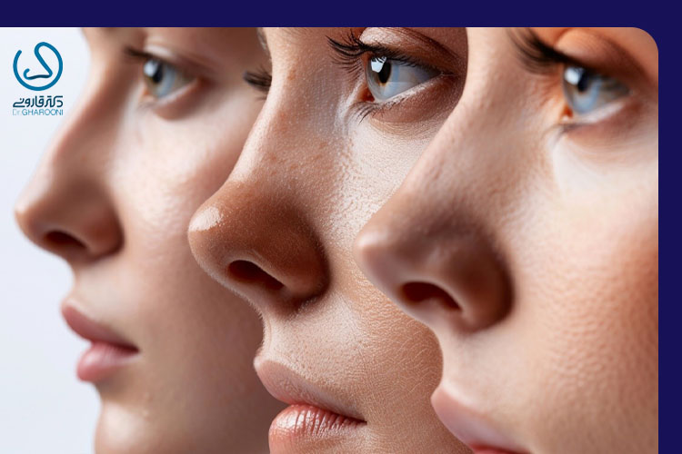 بهترین روش فرم دهی بینی بدون جراحی