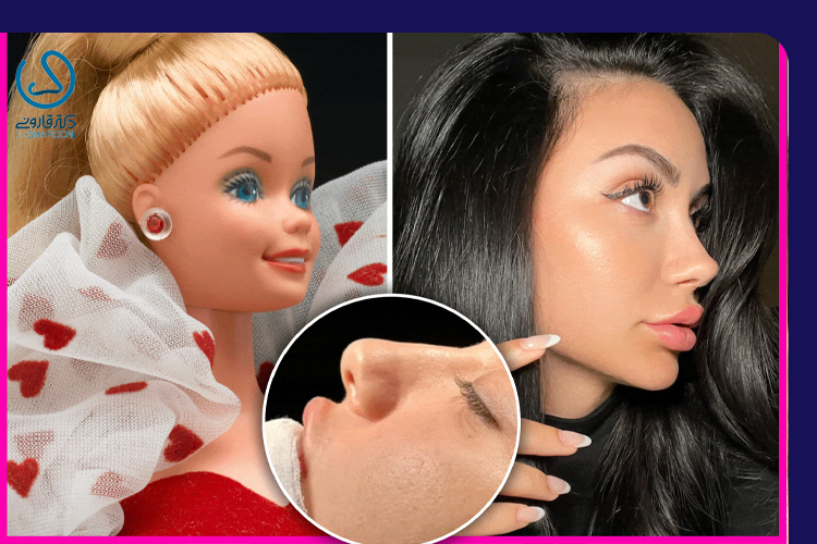 بینی عروسکی و فانتزی